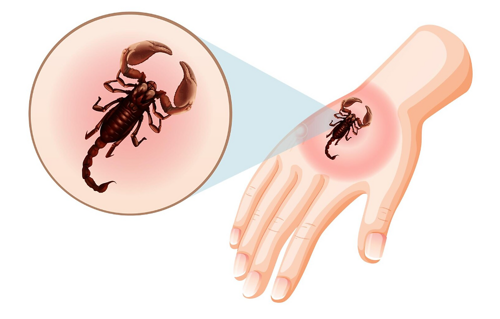 What Does a Scorpion Sting Look Like